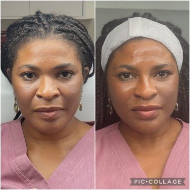 Facial profiling